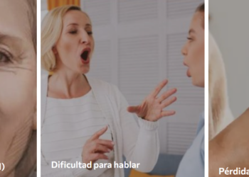 La prevención y el tratamiento del stroke son claves para salvar vidas