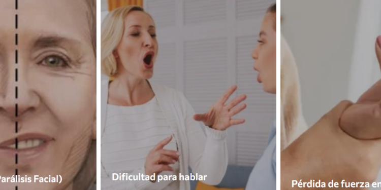 La prevención y el tratamiento del stroke son claves para salvar vidas