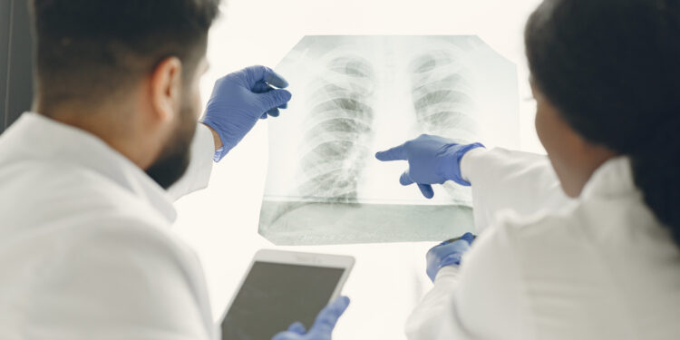 La tuberculosis no es una enfermedad del pasado
